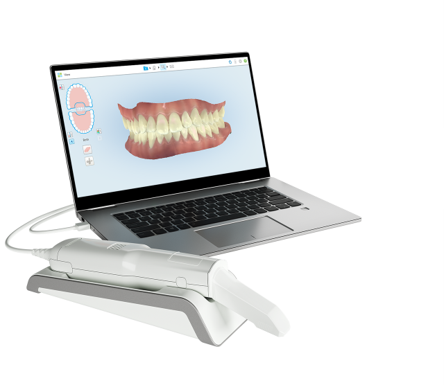 iTero Dental Scanning